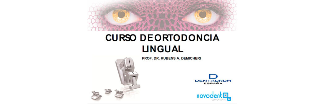 Curso de ortodoncia lingual prof. Dr. Rubens A. Demicheri